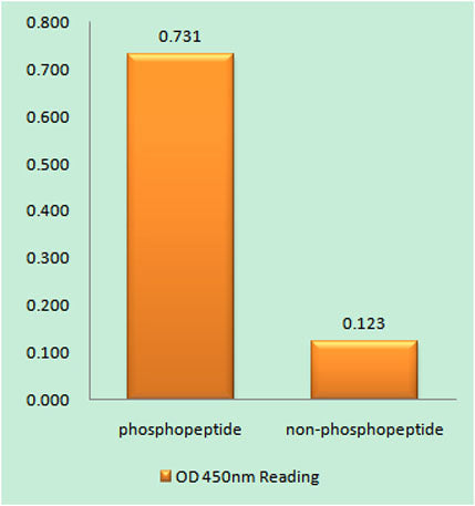 PKC β (phospho Ser661) rabbit pAb
