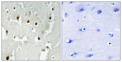 TReP-132 rabbit pAb
