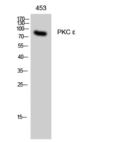 PKC ε rabbit pAb