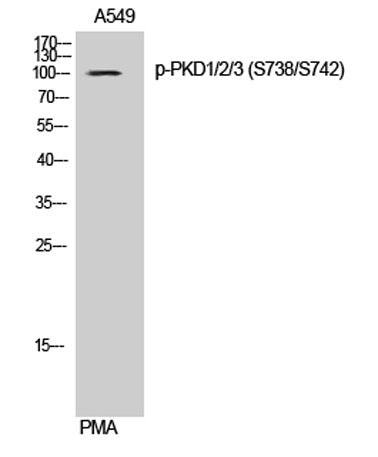 PKD1/2/3 (phospho Ser738/S742) rabbit pAb