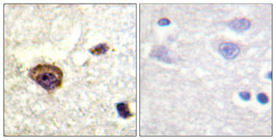 PKC θ (phospho Thr538) rabbit pAb