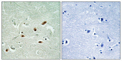 DNA-PKCS (phospho Ser2612) rabbit pAb