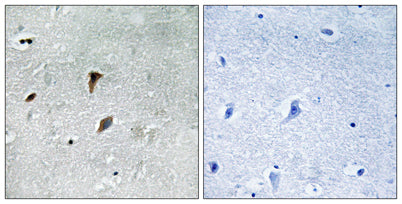 MEK-3 (phospho Thr222) rabbit pAb