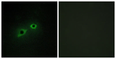 Enterokinase HC rabbit pAb