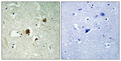 ARHGAP22 rabbit pAb