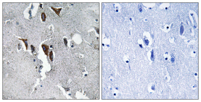 ELOVL5 rabbit pAb