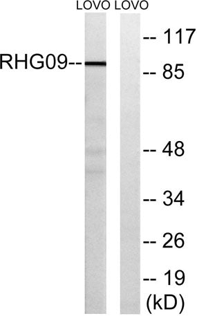 ARHGAP9 rabbit pAb