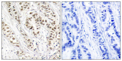 BRCA1 (phospho Ser1524) rabbit pAb
