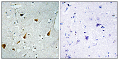 Stat6 rabbit pAb