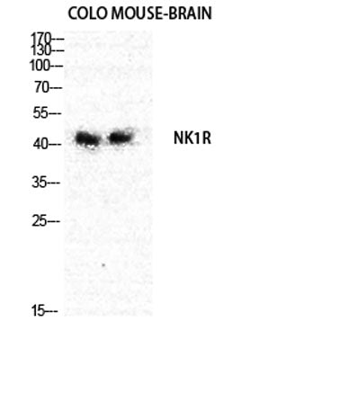 NK-1R rabbit pAb