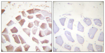Actin-α/γ (phospho Tyr55/53) rabbit pAb