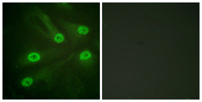 Acetyl p53 (K386) rabbit pAb