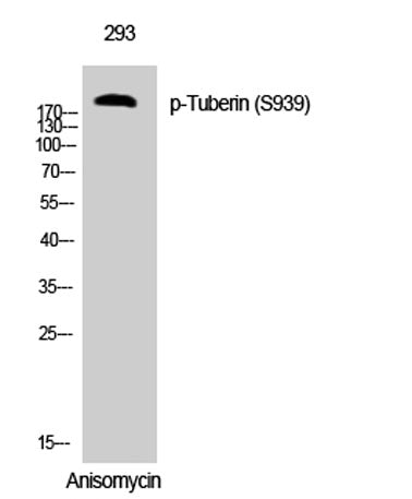 Tuberin (phospho Ser939) rabbit pAb