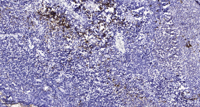 Cubilin rabbit pAb