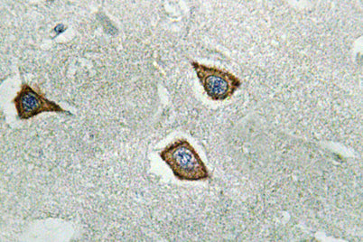 Calpain 2 rabbit pAb