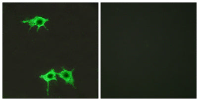 Frizzled-4 rabbit pAb