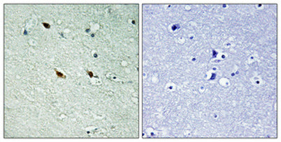 NIFK (phospho Thr234) rabbit pAb