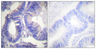 Nck-2 rabbit pAb