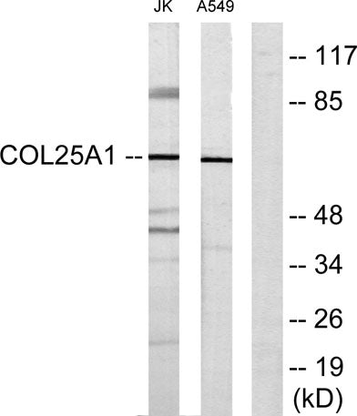 COL25A1 rabbit pAb