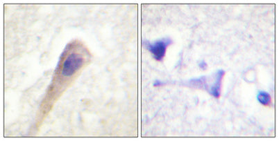 Catalase (phospho Tyr386) rabbit pAb