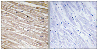 PEA-15 (phospho Ser104) rabbit pAb