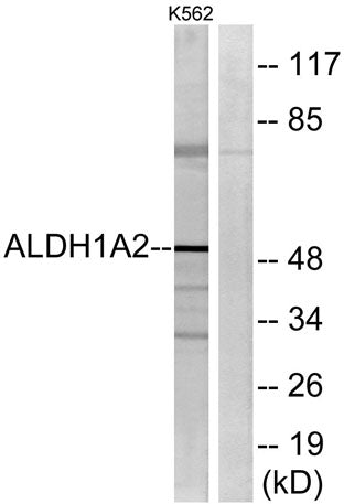 ALDH1A2 rabbit pAb