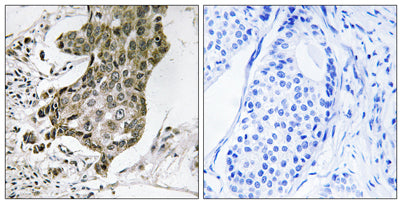 Rabaptin-5α rabbit pAb
