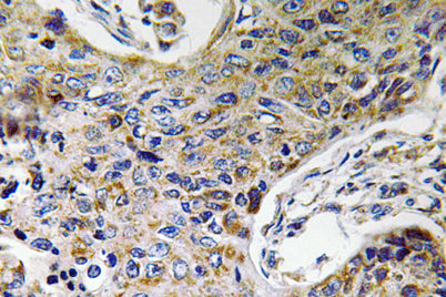 ATP5J2 rabbit pAb