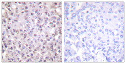 N-CoR rabbit pAb