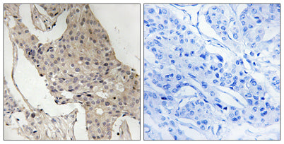 Gab 2 (phospho Ser623) rabbit pAb