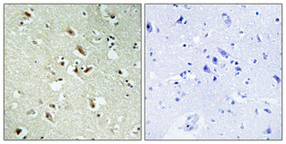 POM121 rabbit pAb