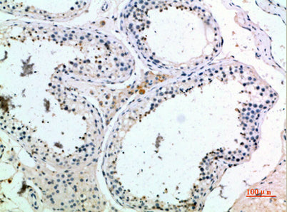 PMCH rabbit pAb