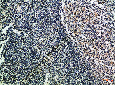 CD52 rabbit pAb