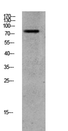GRK2 (Phospho-Ser685) Rabbit pAb
