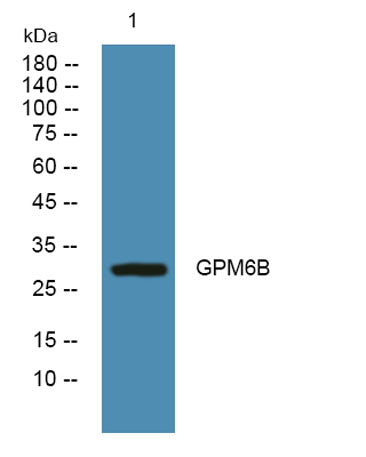 GPM6B rabbit pAb