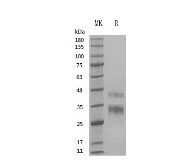 Recombinant Human R-Spondin1