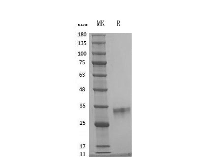 GMP Recombinant Human OSM