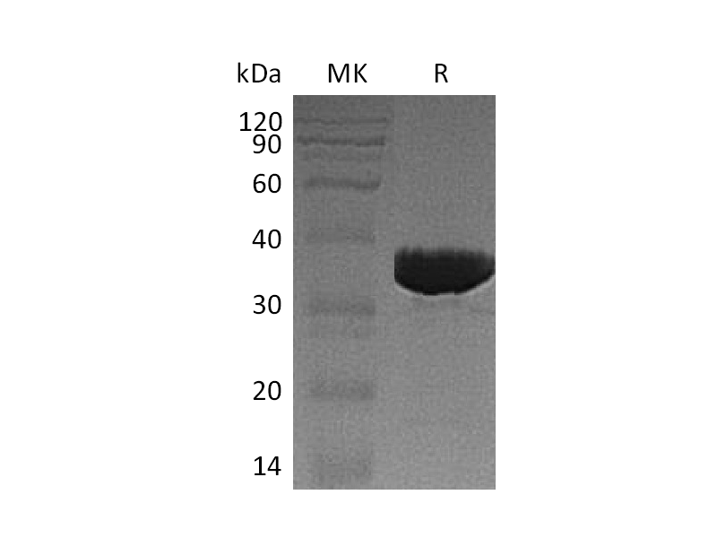 Recombinant Human GALM (C-6His)