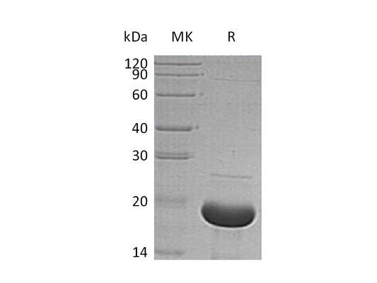 Recombinant Human SNCA (N-6His)