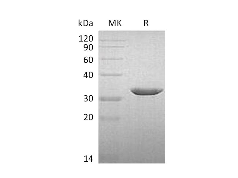 Recombinant Human B3GAT3 (C-6His)
