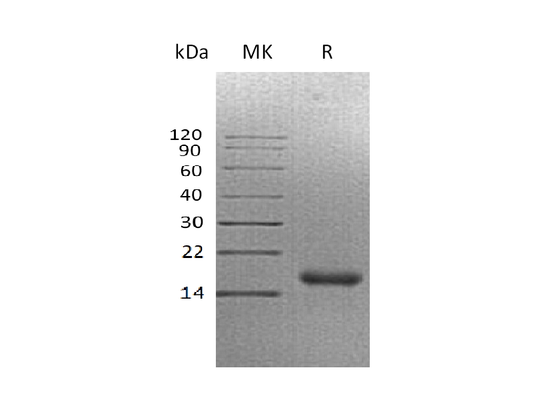 Recombinant Human CALCA (C-6His)