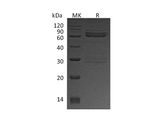 Recombinant Human CAMK1D (N-GST)