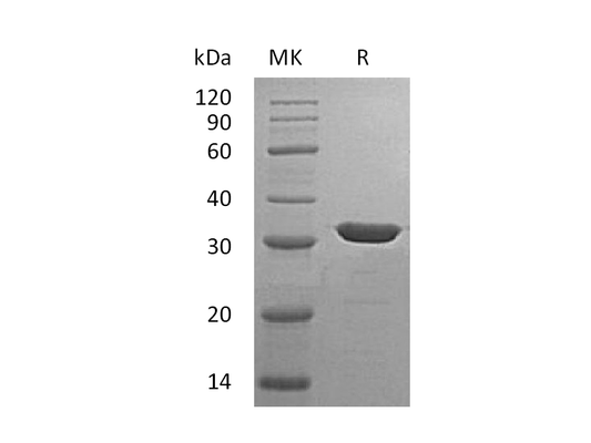 Recombinant Human Carbonic Anhydrase 13 (C-6His)