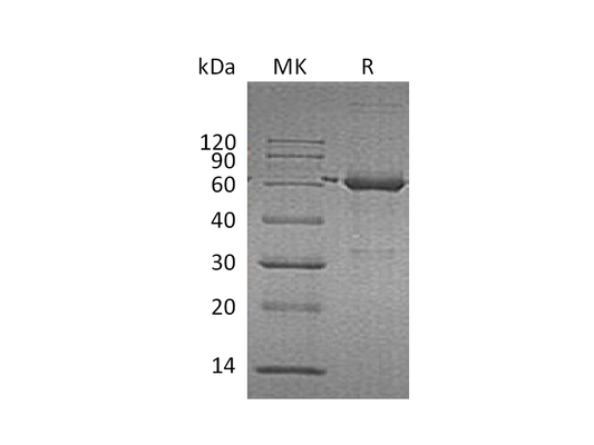 Recombinant Human CAT