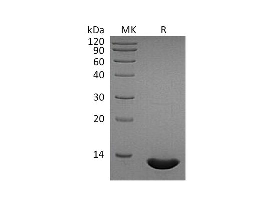 Recombinant Human CCL2