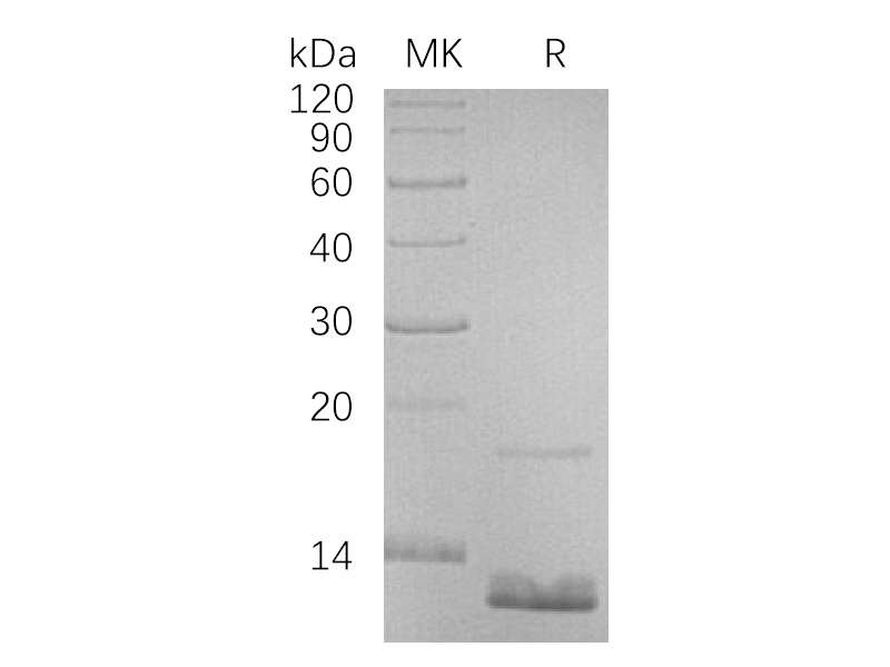 Recombinant Human CCL18 (N-6His)