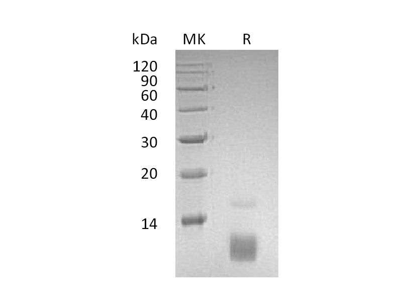 Recombinant Human CCL5