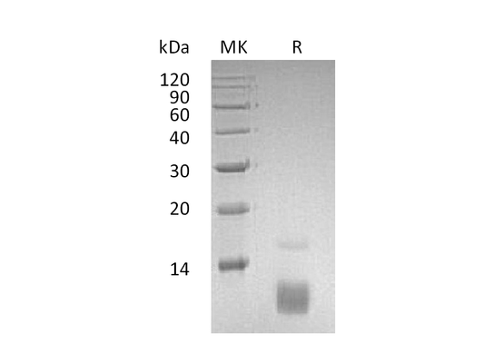 Recombinant Human CCL5