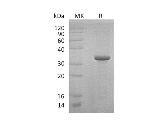Recombinant Human Endoglin (N-Trx-6His)