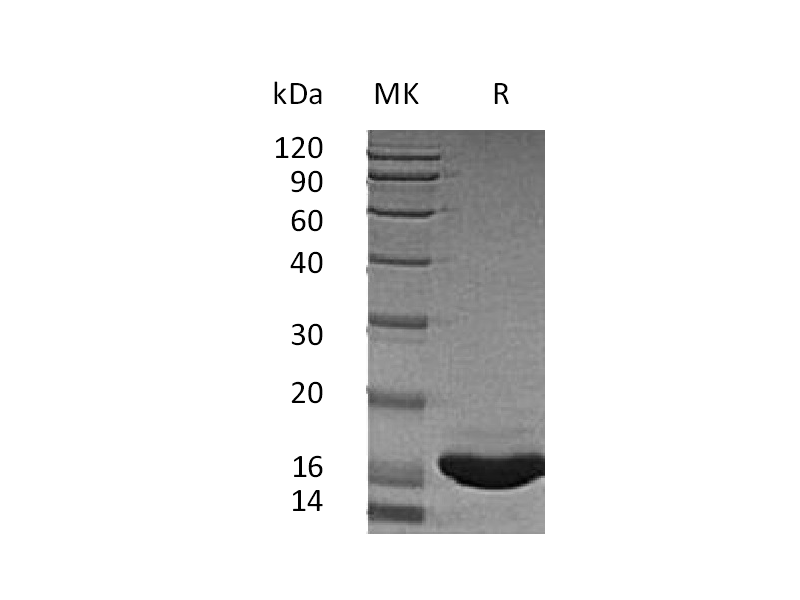 Recombinant Human SCF